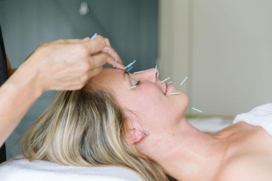 Acupuncture for Facial and Cosmetic Conditions